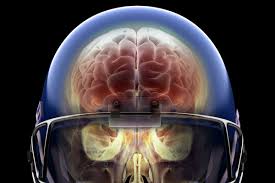Could this be the reason why american men are so violent, because they. Super Bowl 2020 Football Concussions The Link Between Head Injuries And Cte Explained Vox