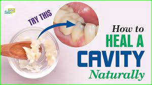 Here is my plan to get rid of cavities at home naturally with nutrition and oil pulling. How To Get Rid Of Cavities Heal And Reverse Youtube
