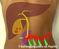 Gallenblase Op Nurnberg Klinik Hallerwiese De