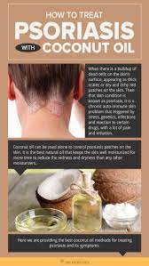 The right combination comprises safe home remedies and a healthy diet! How To Treat Psoriasis With Coconut Oil Diy Natural Home Remedies Here Are Some Of The Reasons That Treat Psoriasis Coconut Oil For Psoriasis Psoriasis Cure