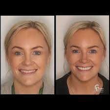 Dr Gary Lunt BDS MSc Pros (@garyluntdentistry) • Instagram photos and videos