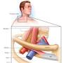 Thoracic outlet syndrome from www.mayoclinic.org
