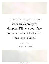 If There Is Love Smallpox Scars Are As Pretty As Dimples I Ll Picture Quotes