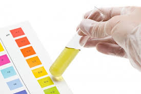 Maybe you would like to learn more about one of these? Tes Urine Sendiri Yuk Di Rumah Begini Tutorialnya Saya Ajarkan