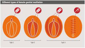 Perintah sunat untuk kaum perempuan tidak lebih populer dibanding anjuran sunat untuk lelaki. Skata