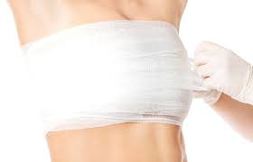 Mammogram) surgical garments and pain medications. Breast Reduction Surgery Prep Recovery And Beyond
