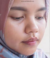 We did not find results for: Beauty Talk Pengalaman Mengatasi Purging Karena Acid Toner Beauty Blog By Rani Oktavia