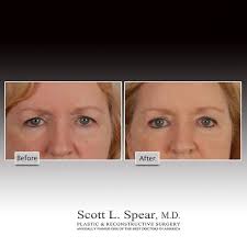 Dr. Scott Spear Plastic Surgery