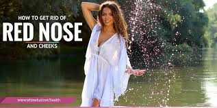 See full list on beautyhows.com Naturally Get Rid Of Redness On Nose And Cheeks Whitedust