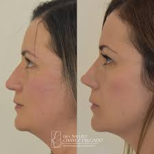 Dra. Nallely Chávez Delgado...