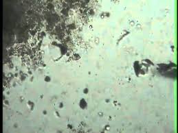 Mixed protozoa, w.m., common forms includin paramecium and amoeba. Mixed Protozoa Mpg Youtube