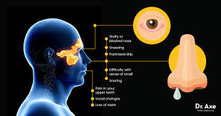 How to remove nasal polyps? Nasal Polyps 19 Natural Treatments Lifestyle Changes Dr Axe