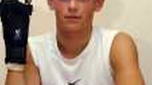 A firework did this to me