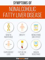 Symptoms Of Nonalcoholic Fatty Liver Disease Natural And Safe Home Remedies Fatty Liver Disease Liver Detox Liver Detox Recipes