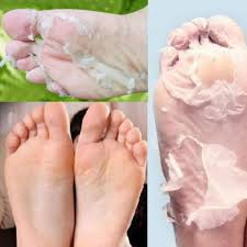 Hot Remove Dead Skin Foot Mask Peeling Cuticles Heel Feet Care Anti Aging Description Lemon Dead Skin Foot Mask Peeling Mask Peeling Cuticles Dead Skin Removal