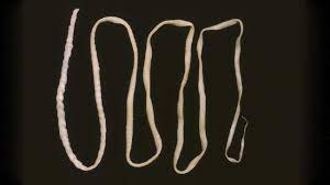Die bandwürmer, zestoden oder cestoden (cestoda, von altgriechisch κεστός. Infektion Arzte Ziehen 2 8 Meter Langen Bandwurm Aus Patienten Welt