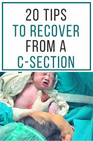 Recovering From A C Section Baby Sleep Problems Postpartum Recovery Breastfeeding