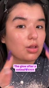 Hi guys! I’ve been so busy with the school year starting, and man when I  tell you I’ve been EXHAUSTED. But my skin has been doing great thanks to  constant hydration, actives and sunscreen! , The new ...