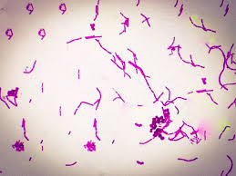 Image result for Staphylococcus Saprophyticus