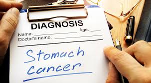 Prin urmare, structura pompei de protoni tubulilor secretori celulele parietale poate concluziona modul mod simplu poate suprima secretia de h + în cavitatea corpului. Noul Studiu LeagÄ Inhibitorii Pompei De Protoni De Cancerul De Stomac Levin Papantonio Rafferty Cabinet De Avocatura Pentru VÄtÄmÄri Corporale