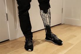 Mais ses dimensions imposantes lui permettent d'embarquer un large plateau d'impression offrant un volume d'impression de 254 x 152 x 170 mm. Impression 3d Medicale Bio Impression 3d Protheses Et Platres