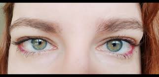 Central heterochromia is when there is an inner ring that is a different color than the outer area of the iris. Kim Newman On Twitter Qorquiq Here Is A Closer Photo In Better Lighting Https T Co Bx11hv2srk Twitter