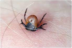 We would like to show you a description here but the site won't allow us. Tick Borne Brain Infection Reported In Uk