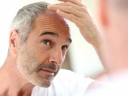 Stops further hair loss in 86% of men and cause substantial hair growth in 65% of men who take the drug, according to the american hair loss association. Hair Loss Treatments For Men 17 Hair Loss Remedies