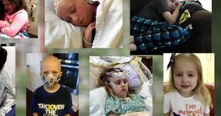 Seeking to solve a pediatric cancer mystery - CBS News