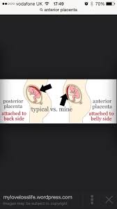 Posterior Vs Anterior Placenta