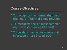 Normal sinus rhythm on an ekg. Ecg Interpretations How To Analyze A Rhythm Normal Sinus Rhythm Heart Arrhythmias Diagnosing A Myocardial Infarction Prezentaciya Onlajn