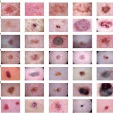 The skin is made up of three layers, including the epidermis, which is the top layer of the skin. Sample Skin Cancer Images From Ham10000 Dataset A Actinic Keratosis Download Scientific Diagram