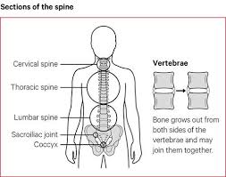 This is called the glenoid. Ankylosing Spondylitis Symptoms Causes Treatments