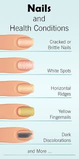 How Your Nails Warn You About Serious Health Conditions Nails Nail Diseases Fingernail Health Nail Health Brittle Nails
