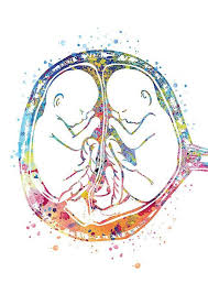 Twin Foetus Medical Art Gift Gynecologist Baby Poster Deco Medicine Clinical Poster Maternity Service Obstetrician Art 315 Art Dessin Illustration