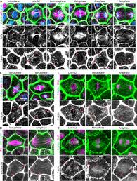 We did not find results for: Spindle F Actin Interactions In Mitotic Spindles In An Intact Vertebrate Epithelium Molecular Biology Of The Cell