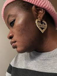 Where can I find turmeric in local shops?