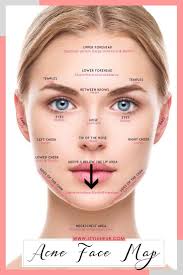 Get Rid Of Cheek Acne Acne On Nose Chin Acne Causes Acne