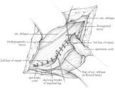 Figure 8 from The Shouldice repair for groin hernias. | Semantic ...
