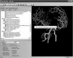 Both comments and trackbacks are currently closed. Labeling View With The List Of Vessels Names From The Terminologia Download Scientific Diagram