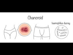 Image result for chancroid
