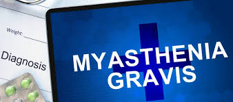 Currently, there's no cure for myasthenia gravis. Fda To Review Efgartigimod For Generalized Myasthenia Gravis Mpr