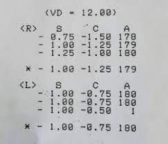 Uzman Erbas Muayenesi Goz Dereceleri Nelerdir Goz Derecesi Kac Olmalidir Askeri Bilgiler