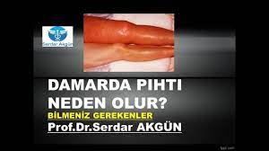 Damarda Pihti Neden Olur Youtube