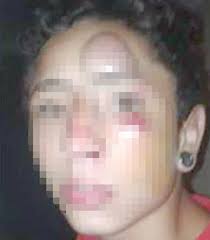 Un hombre desfiguró a golpes a un menor de 13 años en Aimogasta