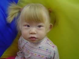 25 Photos Of Asian People With Blue Eyes Albino Girl People With Blue Eyes Blonde Asian
