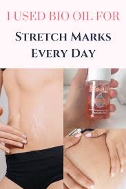 Bio Oil Before And After Face I Used Bio Oil For Stretch Marks Every Day Here Is What You Should Know Oil For Stretch Marks Bio Oil Bio Oil Stretch Marks