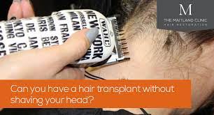 News The Maitland Clinic Hair Restoration