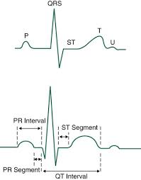 Image result for Electrocardiogram
