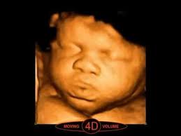 4d Mobile Ultrasound Gender Reveal Ultrasound Mobile Gender Reveals Tampa Bay Fl Gender Reveal Ultrasound 4d Ultrasound 3d Ultrasound
